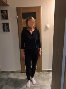 figura po odchudzaniu